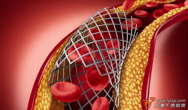 高氮無鎳不銹鋼心臟支架 高氮無鎳不銹鋼心臟支架